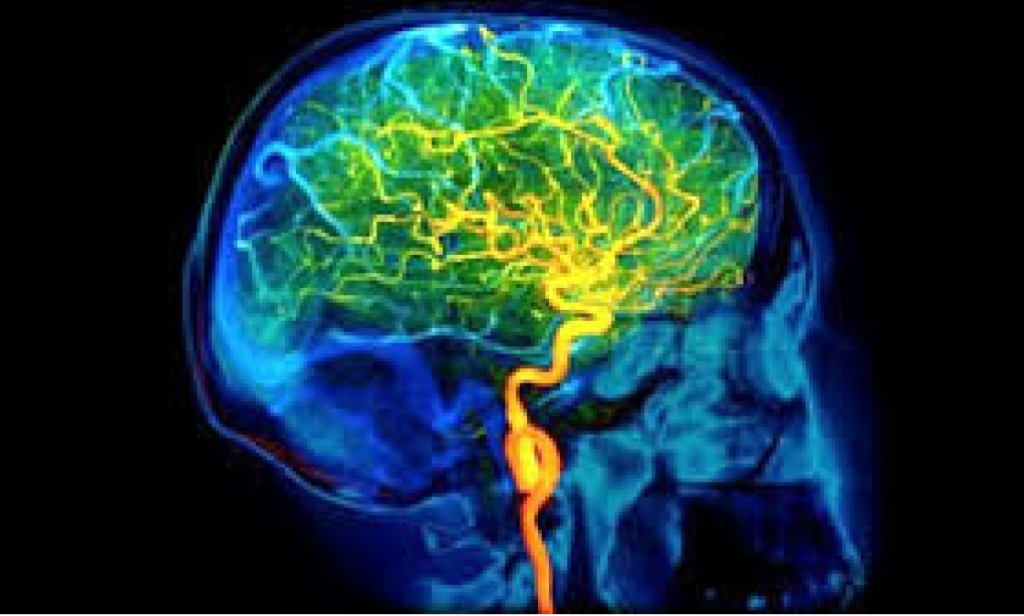 Cognishield Review 3